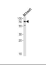 HAS2 Antibody in Western Blot (WB)