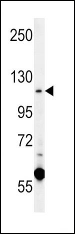 CACNA2D4 Antibody in Western Blot (WB)