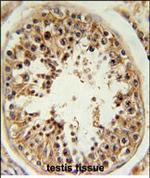 RSPO4 Antibody in Immunohistochemistry (Paraffin) (IHC (P))