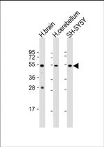 beta-3 Tubulin Antibody in Western Blot (WB)