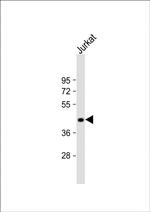 ST3GAL5 Antibody in Western Blot (WB)