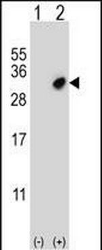 GSTO2 Antibody in Western Blot (WB)