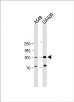 RASGRP1 Antibody in Western Blot (WB)