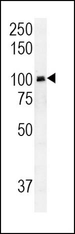 RASGRP1 Antibody in Western Blot (WB)