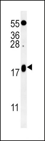 VAMP4 Antibody in Western Blot (WB)