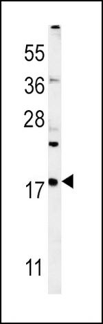 VAMP4 Antibody in Western Blot (WB)