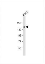 ADCY10 Antibody in Western Blot (WB)