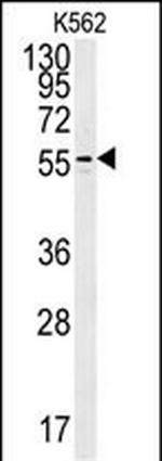 PAOX Antibody in Western Blot (WB)