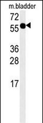 ADSSL1 Antibody in Western Blot (WB)