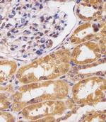 CUX1 Antibody in Immunohistochemistry (Paraffin) (IHC (P))