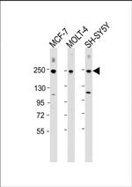 CUX1 Antibody in Western Blot (WB)