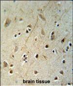 HEY2 Antibody in Immunohistochemistry (Paraffin) (IHC (P))