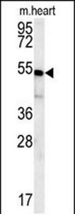 HEY2 Antibody in Western Blot (WB)