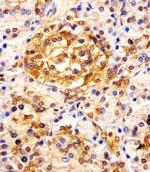 ESRP1 Antibody in Immunohistochemistry (Paraffin) (IHC (P))