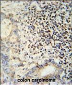 ESRP1 Antibody in Immunohistochemistry (Paraffin) (IHC (P))