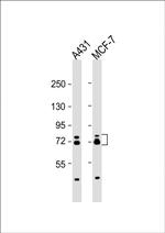 ESRP1 Antibody in Western Blot (WB)