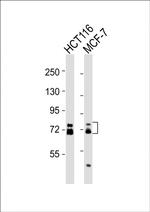 ESRP1 Antibody in Western Blot (WB)