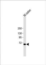 ESRP1 Antibody in Western Blot (WB)