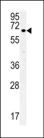 ESRP1 Antibody in Western Blot (WB)