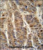 C4BPA Antibody in Immunohistochemistry (Paraffin) (IHC (P))