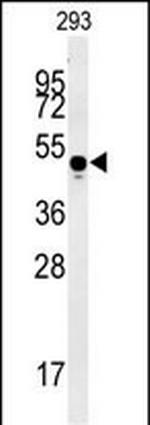 MYLK4 Antibody in Western Blot (WB)