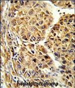 CYP2C19 Antibody in Immunohistochemistry (Paraffin) (IHC (P))