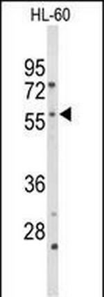 CYP2C19 Antibody in Western Blot (WB)