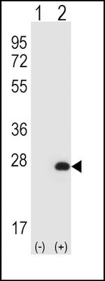 HPRT1 Antibody in Western Blot (WB)