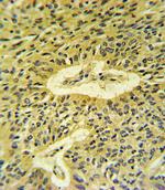 SMAD7 Antibody in Immunohistochemistry (Paraffin) (IHC (P))