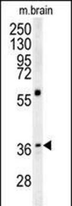 EB1 Antibody in Western Blot (WB)