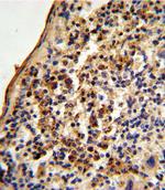 Ku70 Antibody in Immunohistochemistry (Paraffin) (IHC (P))