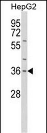 IL-1 alpha Antibody in Western Blot (WB)