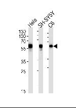 Calreticulin Antibody in Western Blot (WB)