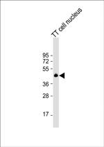 Nkx2.1 Antibody in Western Blot (WB)