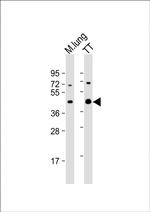 Nkx2.1 Antibody in Western Blot (WB)