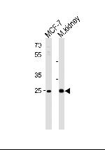 Carbonic Anhydrase II Antibody in Western Blot (WB)