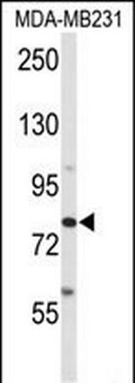 ADAM9 Antibody in Western Blot (WB)