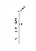 PAX6 Antibody in Western Blot (WB)