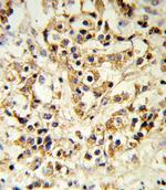 FGFR1 Antibody in Immunohistochemistry (Paraffin) (IHC (P))