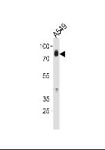 HCK Antibody in Western Blot (WB)