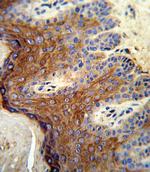 ALOX12 Antibody in Immunohistochemistry (Paraffin) (IHC (P))