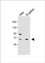 ALOX12 Antibody in Western Blot (WB)