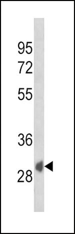 SFRP1 Antibody in Western Blot (WB)