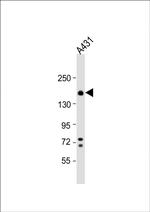 ITGA2 Antibody in Western Blot (WB)