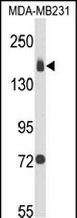 ITGA2 Antibody in Western Blot (WB)