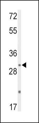 DUSP2 Antibody in Western Blot (WB)