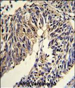 TNFRSF14 Antibody in Immunohistochemistry (Paraffin) (IHC (P))