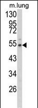 Fibulin 3 Antibody in Western Blot (WB)