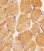 GCLM Antibody in Immunohistochemistry (Paraffin) (IHC (P))