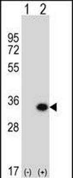 GCLM Antibody in Western Blot (WB)